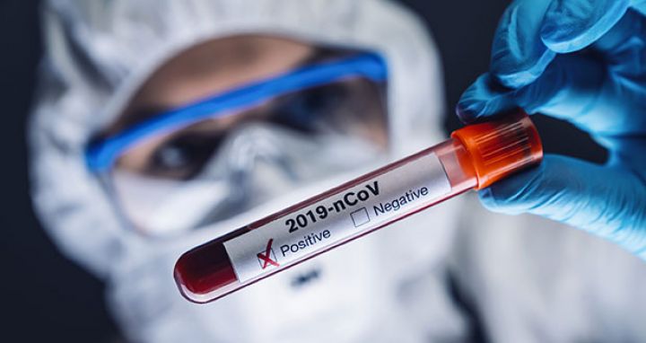 Azərbaycanda koronavirus ilə bağlı son vəziyyət açıqlandı