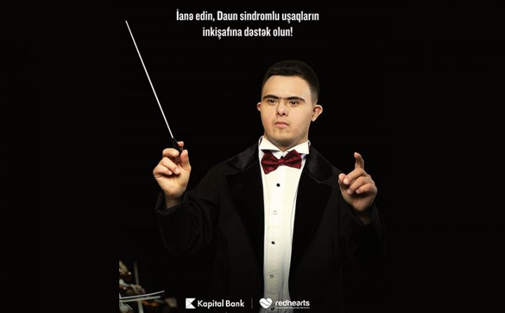 Daun sindromlu şəxslər üçün yeni layihə həyata keçirirlir