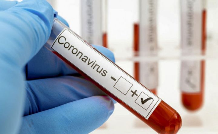 Azərbaycanda son 1 həftədə koronavirus ilə bağlı son vəziyyət